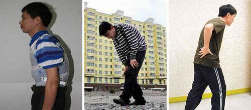 ֣��ʹ���ʪ��ҽԺǿֱ�Լ����������Źؽ��ۡ�ʹ��׵���� 